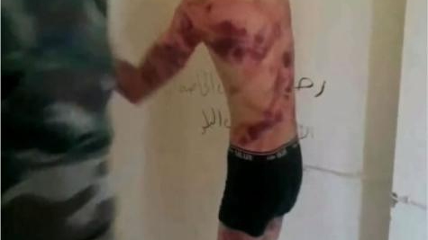 215.. فرع الموت والجنون