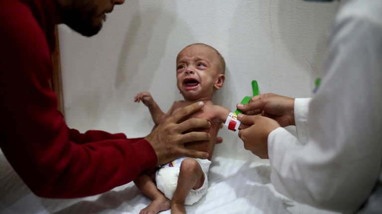 اليونيسف: الغوطة الشرقية أصبحت جحيمًا على الأطفال السوريين