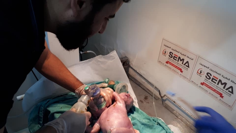 في حالة نادرة .. ولادة طفل برأسين بريف إدلب