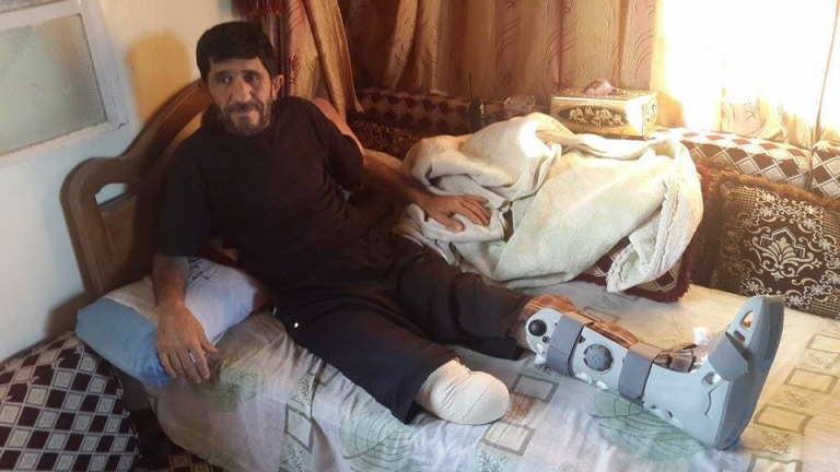 لغم أرضي.. يفقد جمال ساقه!