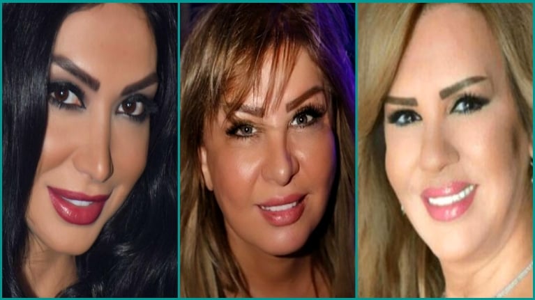 مخرجة سوريّة: الجمال الطبيعي للممثلات انقرض بسبب عمليات التجميل 