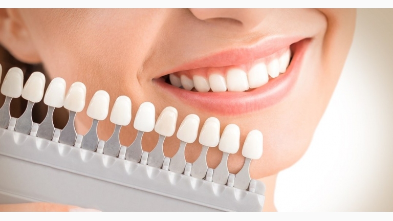 تعرف على طرق تجميل الأسنان وتبييضها
