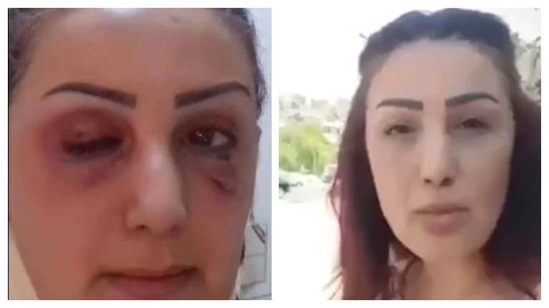 بعد انتقادها الواقع المعيشي.. هل تعرّضت مذيعة سورية للضرب؟